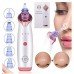 Lux Pore Suction